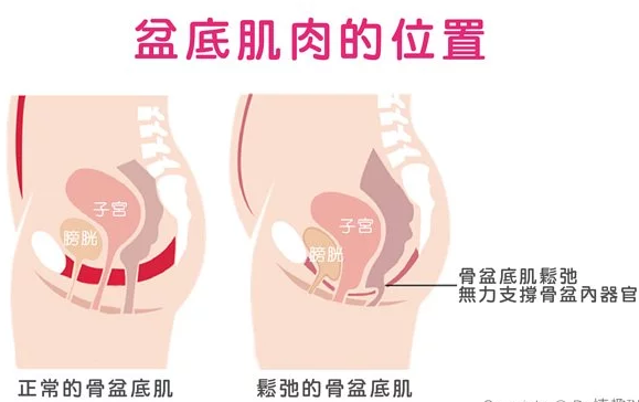 聪明球的使用方法及挑选技巧