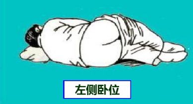 左侧卧位
